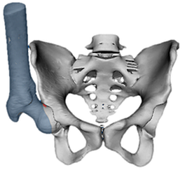 Illustration of the pelvis and femur bones