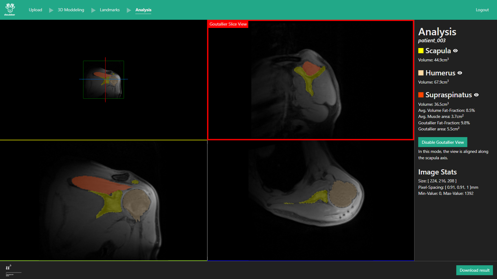 Interface of our software for fat fraction analysis of shoulder muscles