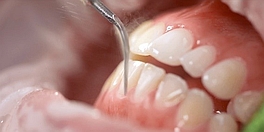 image of teeth